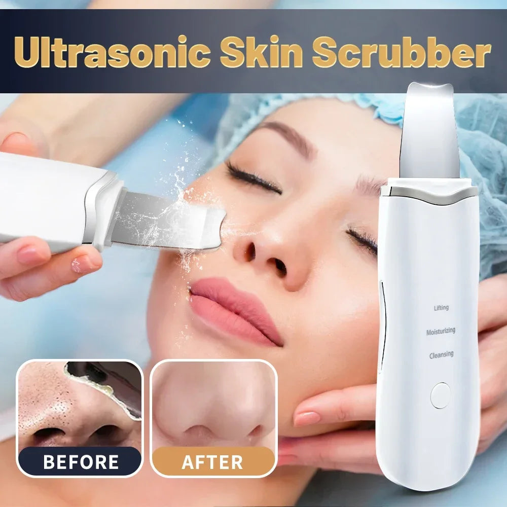 Professional Ultrasonic Facial Skin Scrubber – Deep Cleansing & Gentle Exfoliation Device
